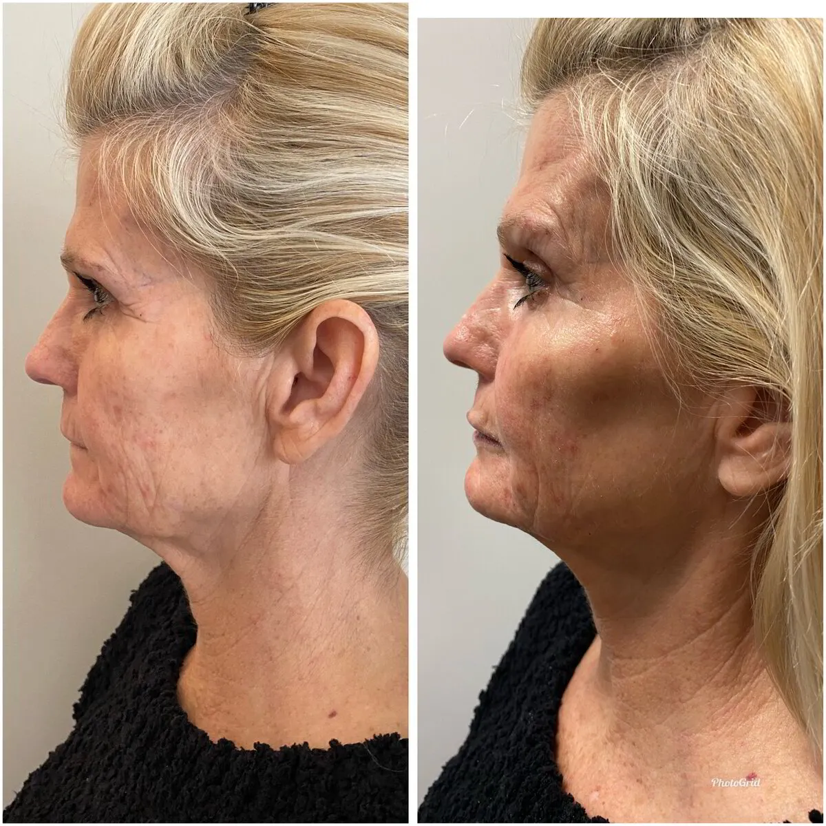 Facial Aesthetics Nashville