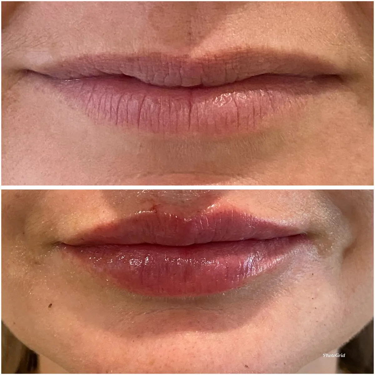 Facial Aesthetics Nashville