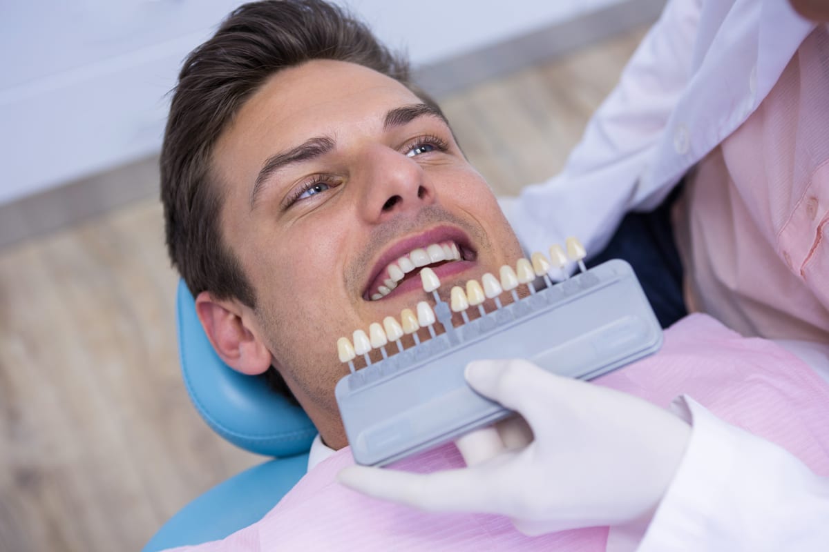 Veneers in Nashville