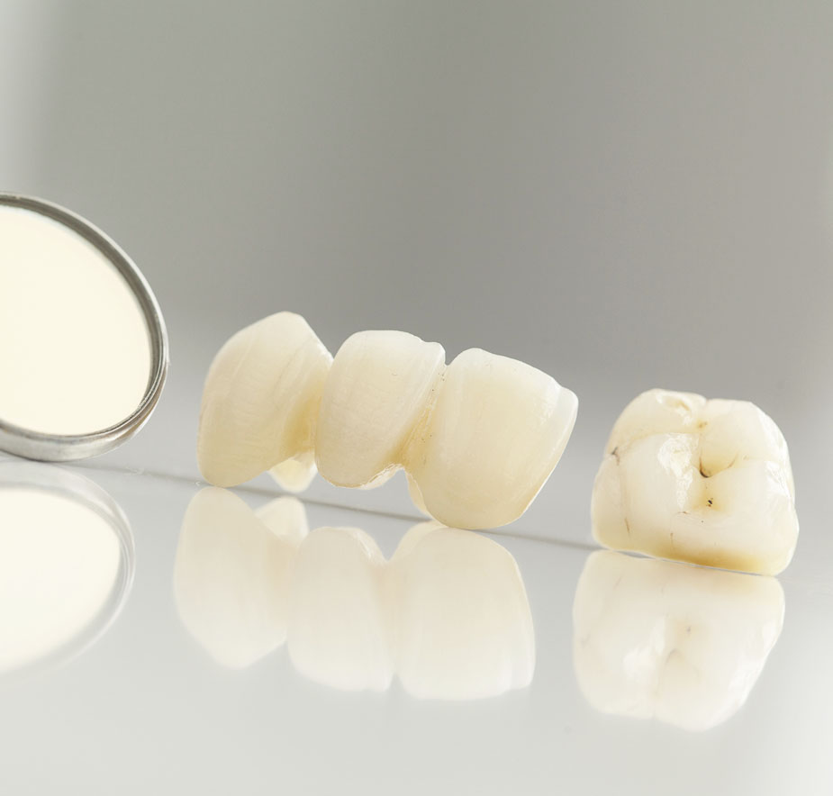 Tooth extractions in Brentwood and Lewisburg, TN