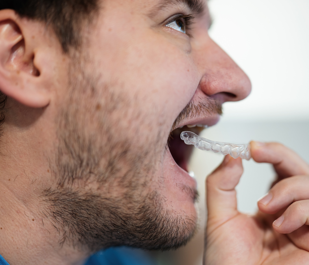 Smiling patient wearing Invisalign clear aligners