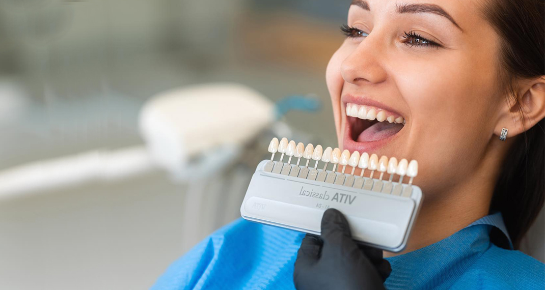 Dentist assisting a patient in selecting the correct dental veneer shade.