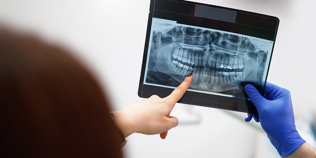 Dentist showing dental Digital X-Rays image