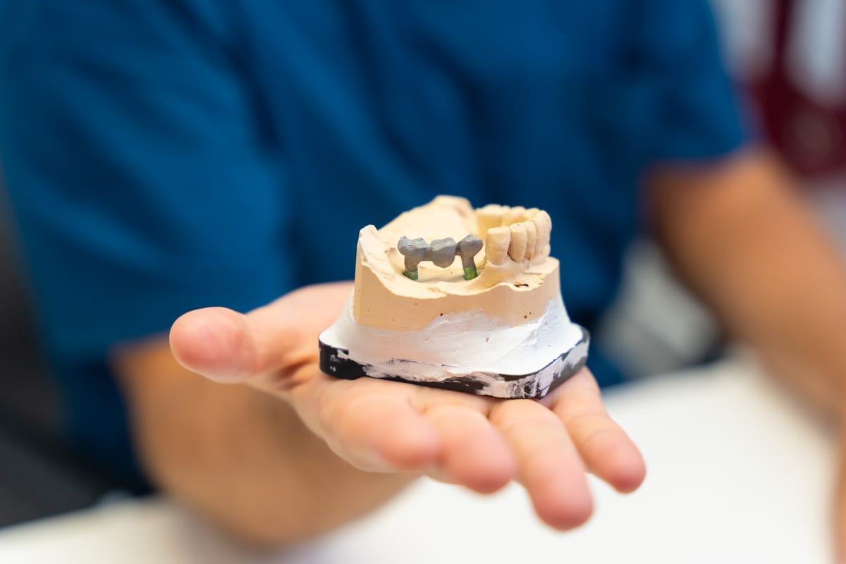 Dental Crowns in Brentwood