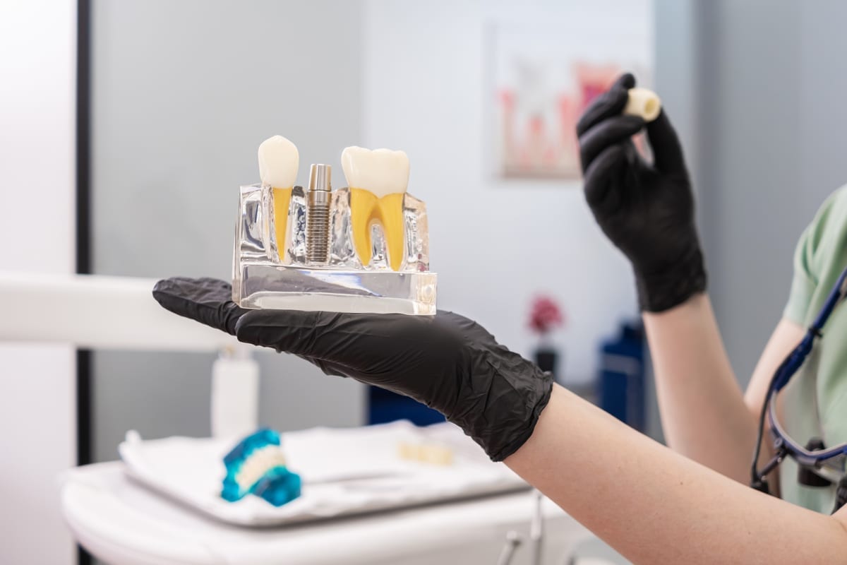 Dental Crowns in Lewisburg