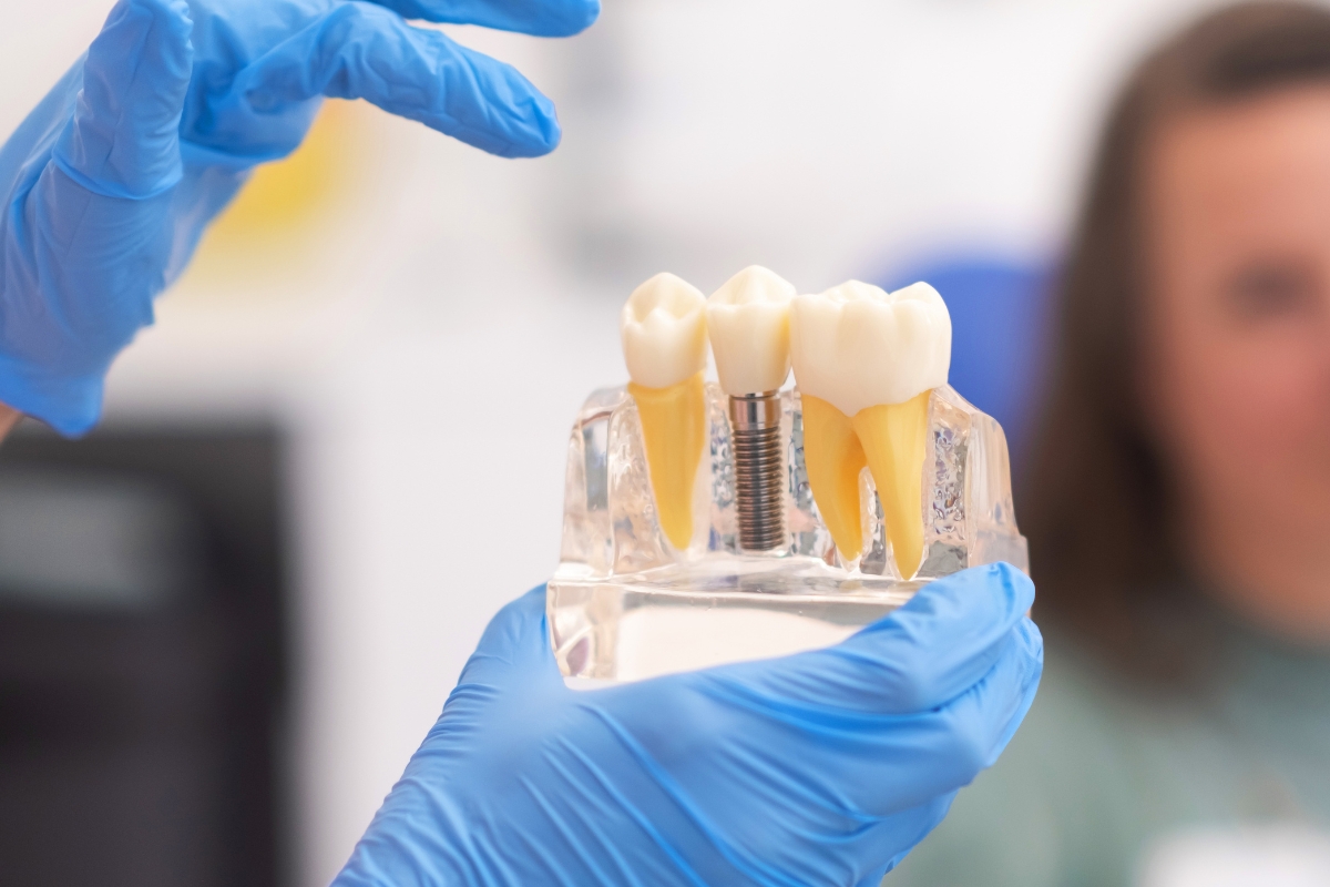 close-up-dental-implant-model
