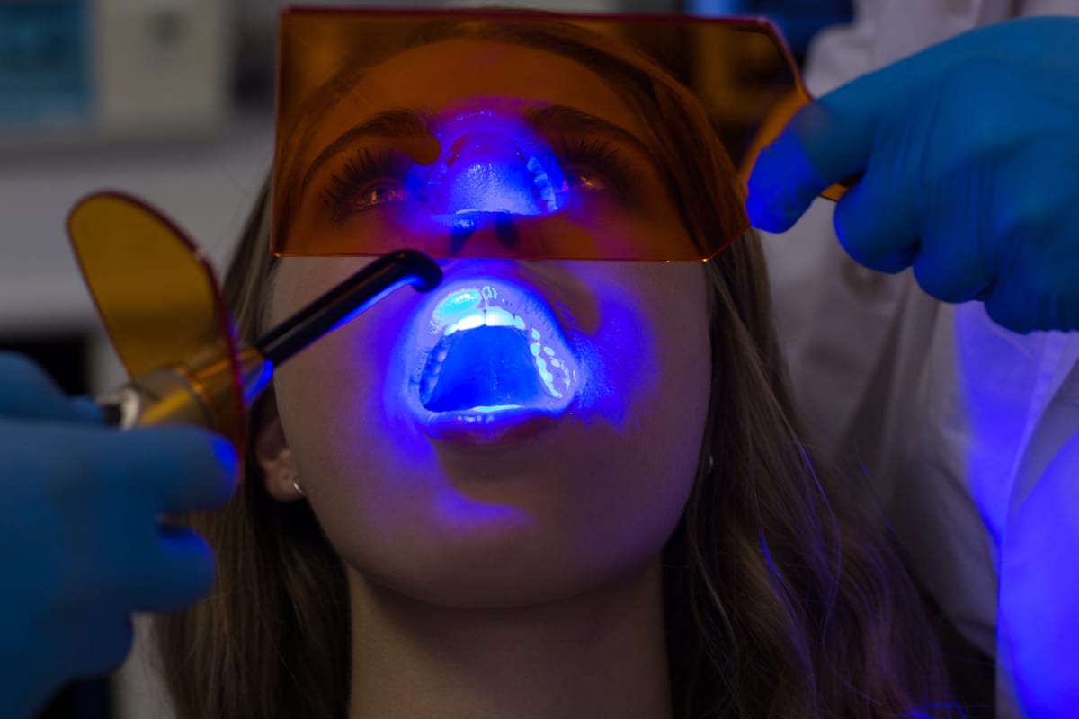 Teeth Whitening in Austin