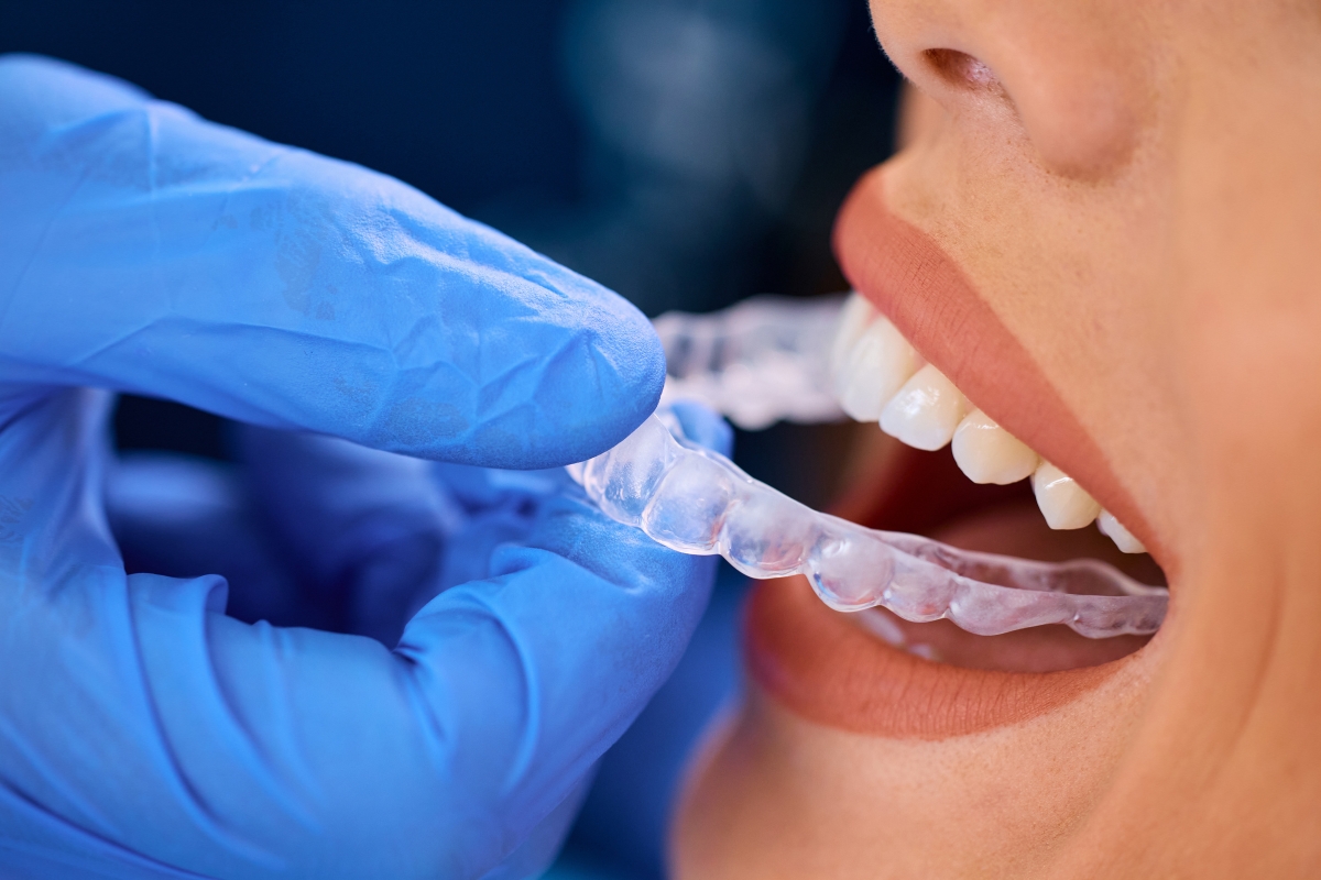 Invisalign Franklin
