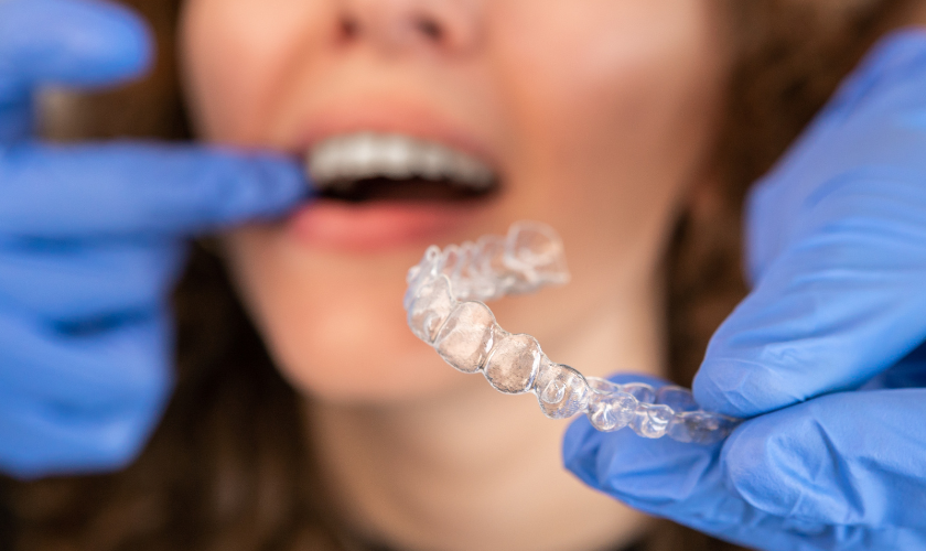 Featured image for “What to do if your Invisalign Aligner is Cutting Your Gums?”