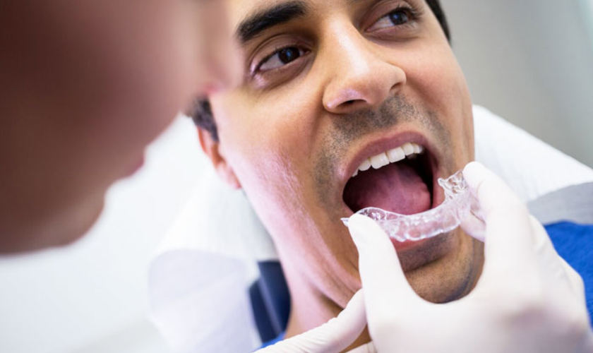 Featured image for “A Comprehensive Guide to Invisalign: What to Expect During Your Treatment”