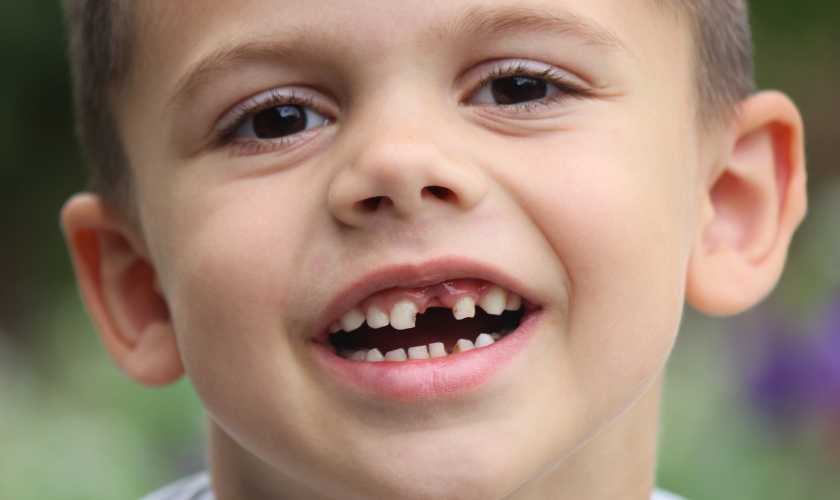 Featured image for “What Is The Most Common Teeth Problem In Children?”