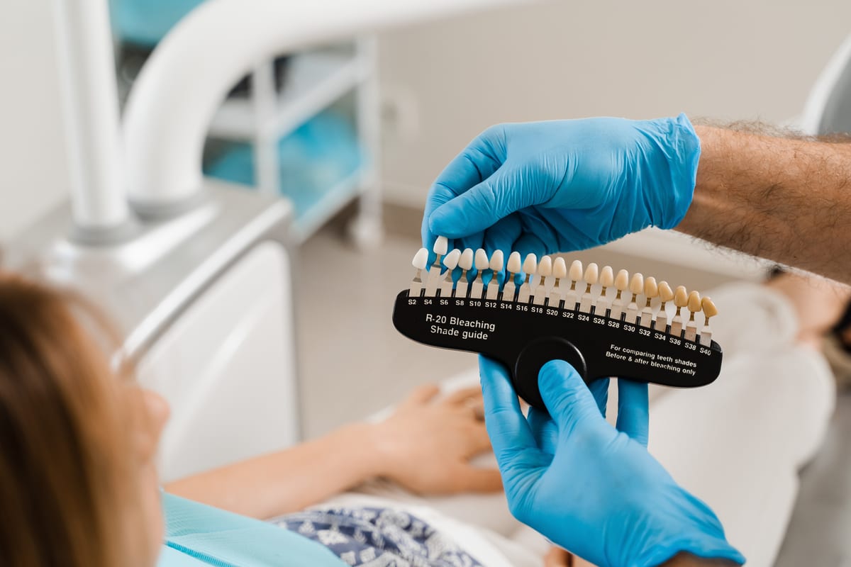 Featured image for “What Happens to Your Teeth During Veneer Placement: Step-by-Step”