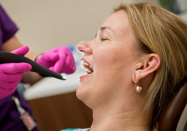 intra-oral cameras