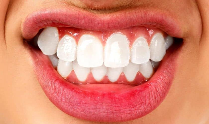 Bruxism symptoms and treatment 