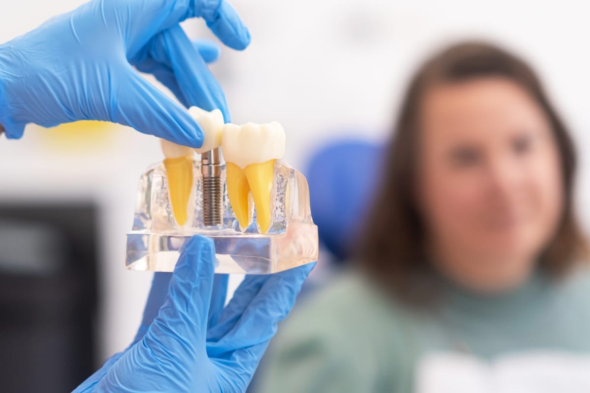 Implantes dentales en Lakeview y Roscoe Village