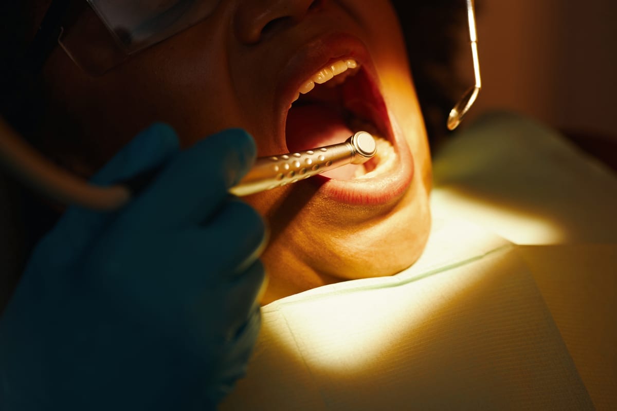 Root Canal Treatment in Chicago