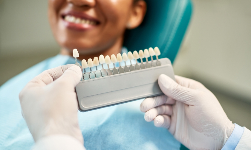 common myths about veneers in iowa city