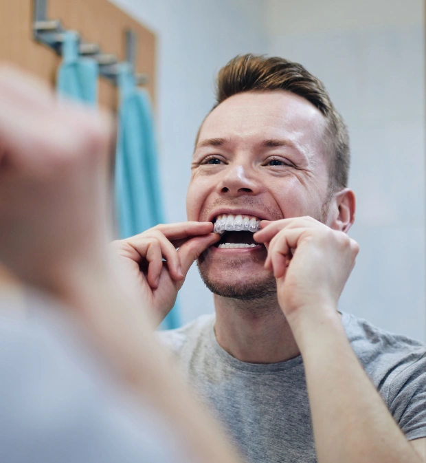 img-clear-aligners