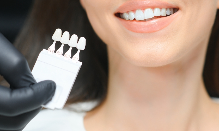 veneers and face-lifts