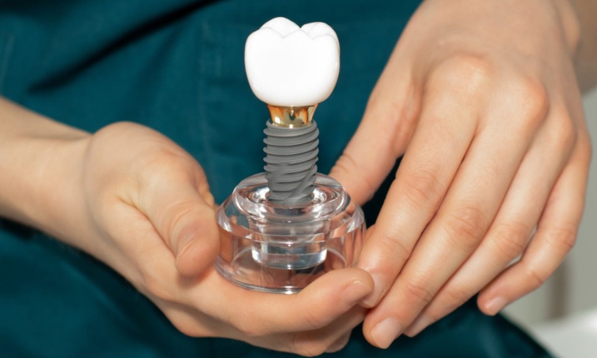 dental implants in Iowa City