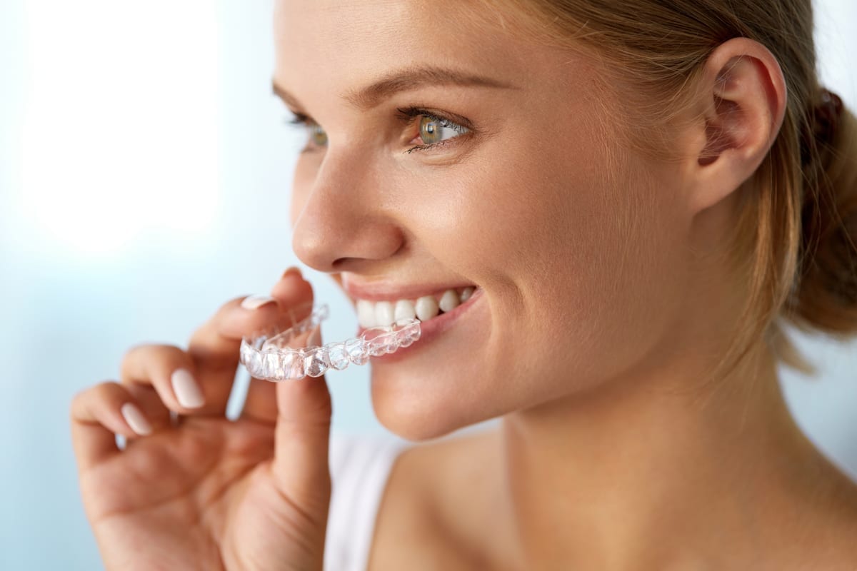 Invisalign in Iowa City