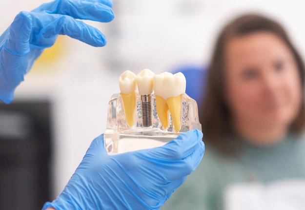 Dental Implant in Irvine, CA