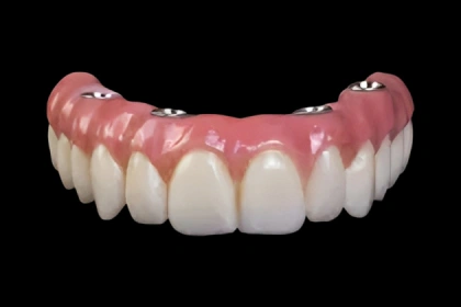 hybrid implant dentures Irvine