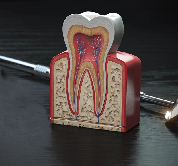 Root Canals in Irvine, CA