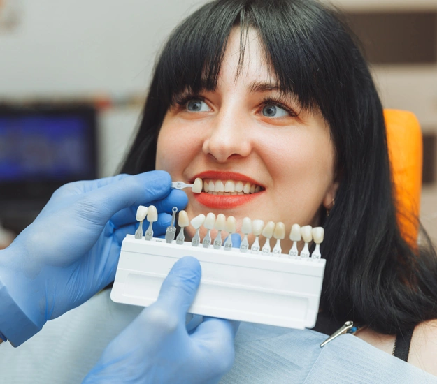 Veneers in Irvine, CA