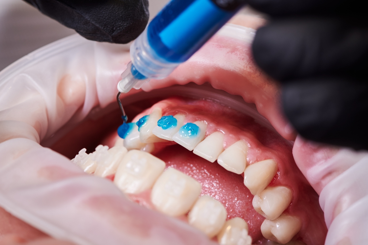 Cosmetic Dentist Irvine