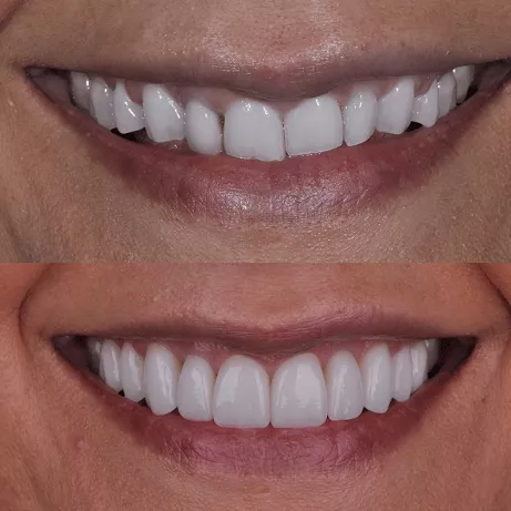 General Dentistry Seattle | West Seattle Smile Co.