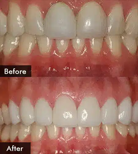cosmetic dentist in joplin