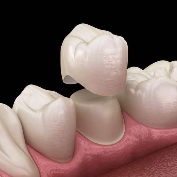 dentures in joplin