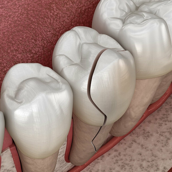 dentures in joplin
