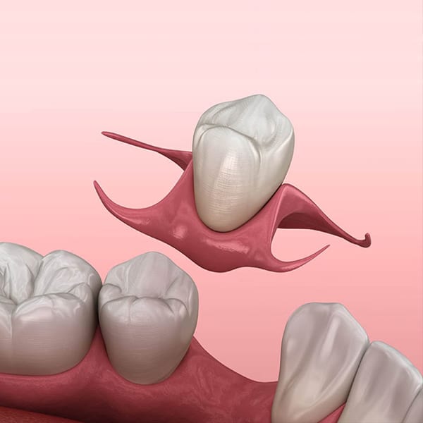 dentures in joplin
