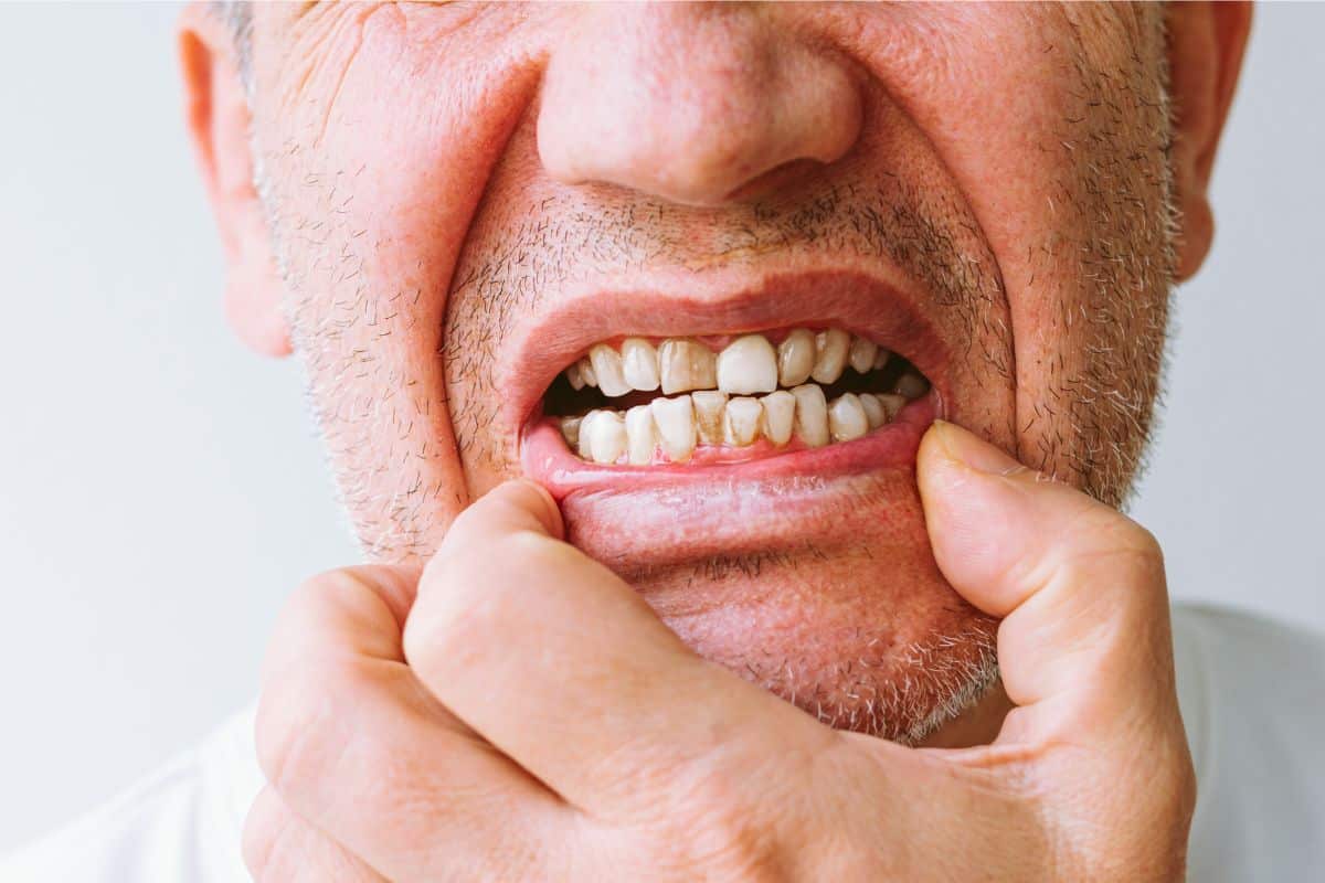 How Diabetes Affects Oral Health