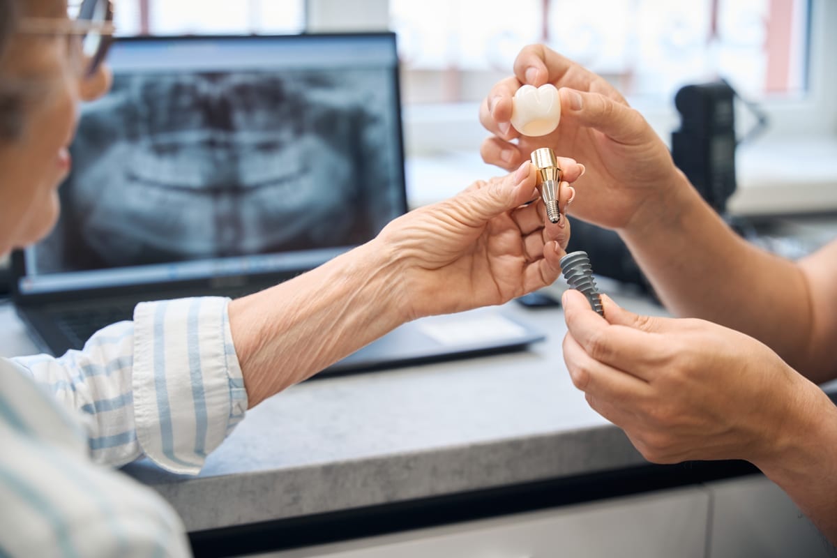 Dental Implants in Joplin