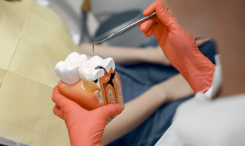 Dental fissure sealants
