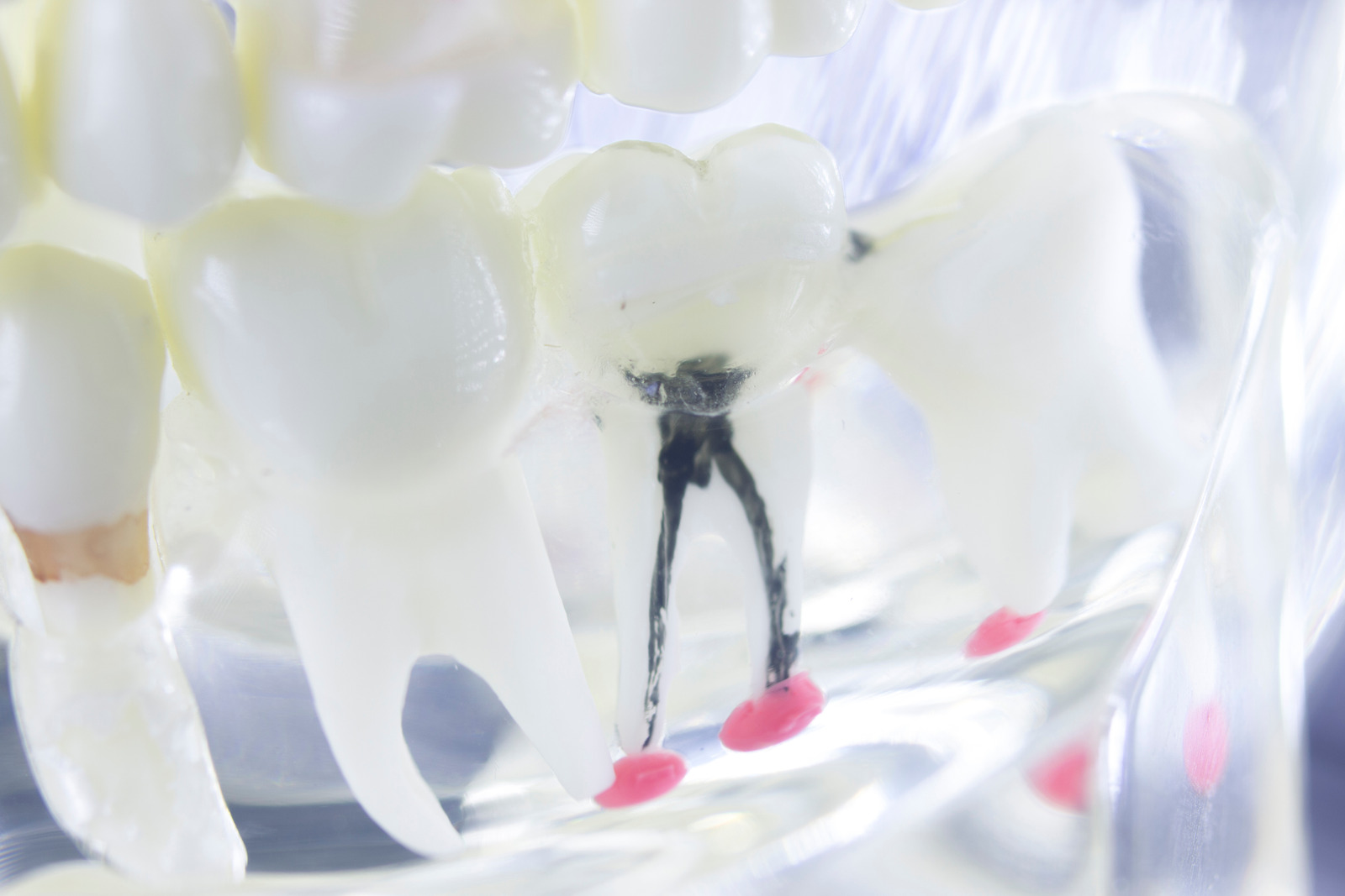 pediatric root canal treatment in bradley il, joyful smiles pediatric dentistry of bradley
