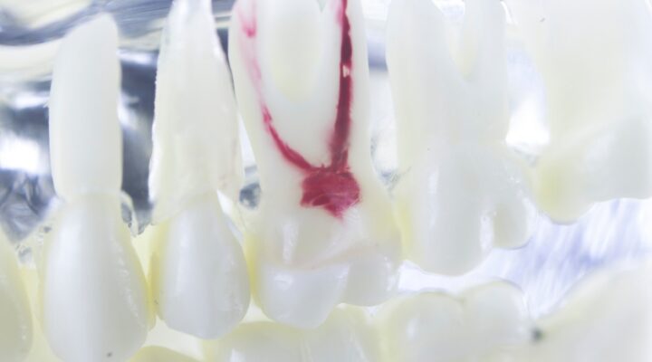 childrens root canal therapy in bradley il