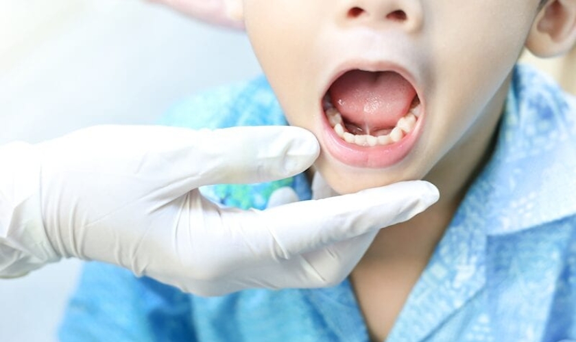 What To Expect After Frenectomy In Infants?