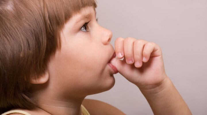 can thumb-sucking or pacifier use lead to orthodontic problems in bradley kids