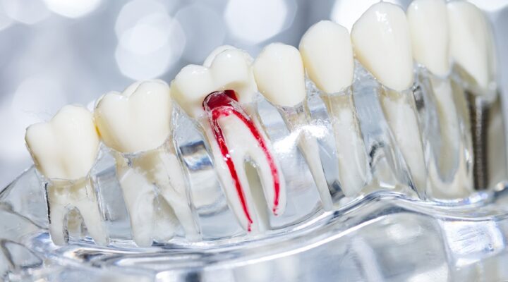 root canal therapy for children in Bradley Illinois