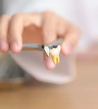 extractions