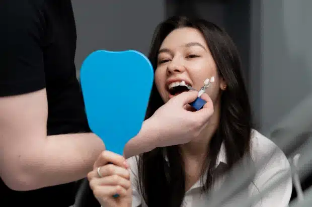 Dental Veneers