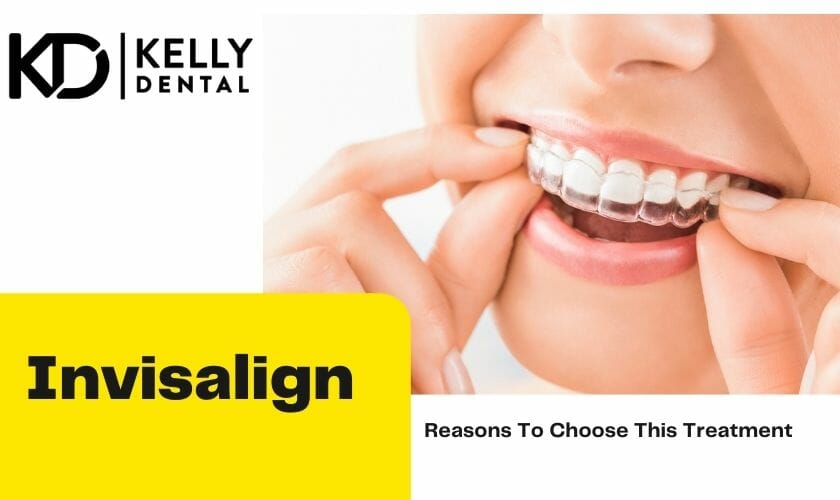 Invisalign Springfield