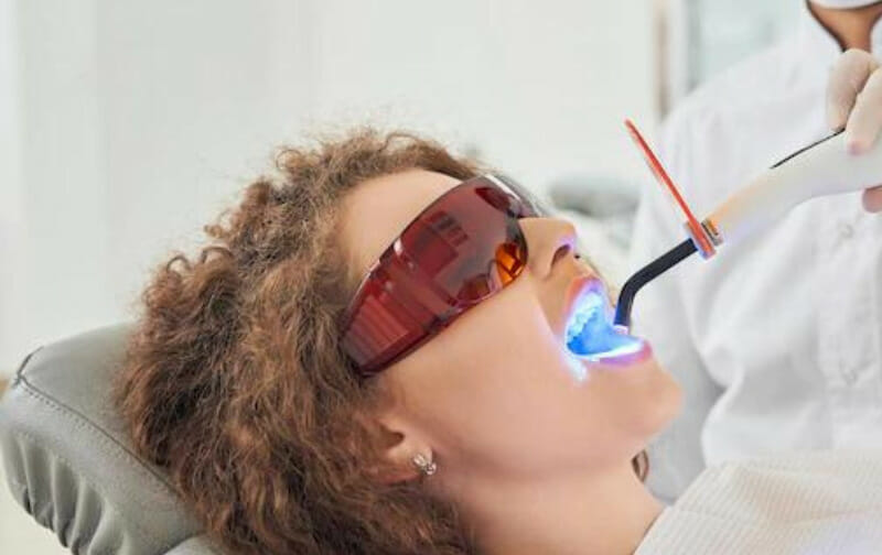 Teeth Whitening Springfield