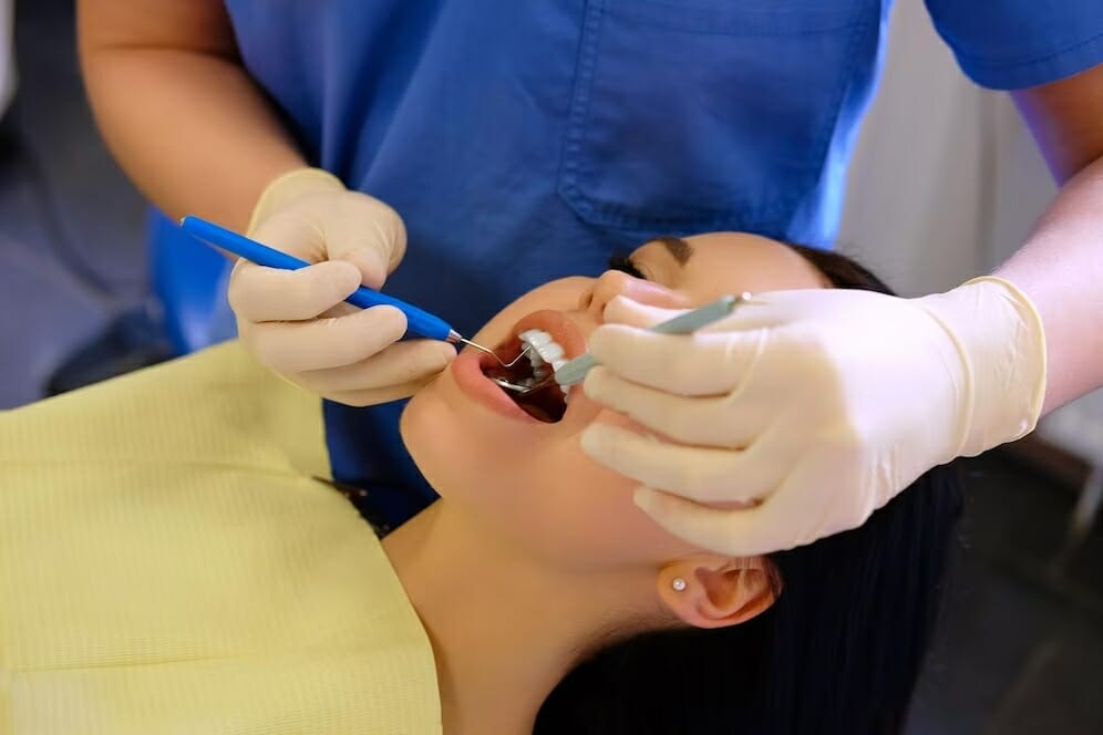 cavity fillings in Springfield