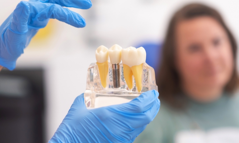 osteoporosis and dental implants