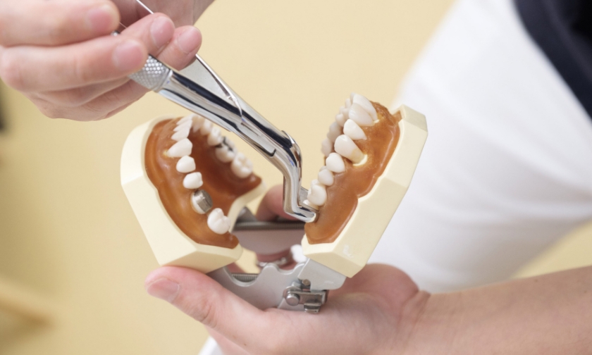Diabetes and Tooth Extractions: Managing Blood Sugar